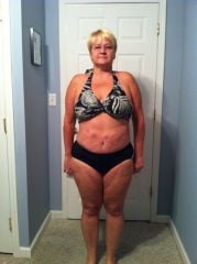 4 weeks post surgery 190 lbs