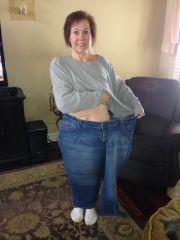 1 year post op
