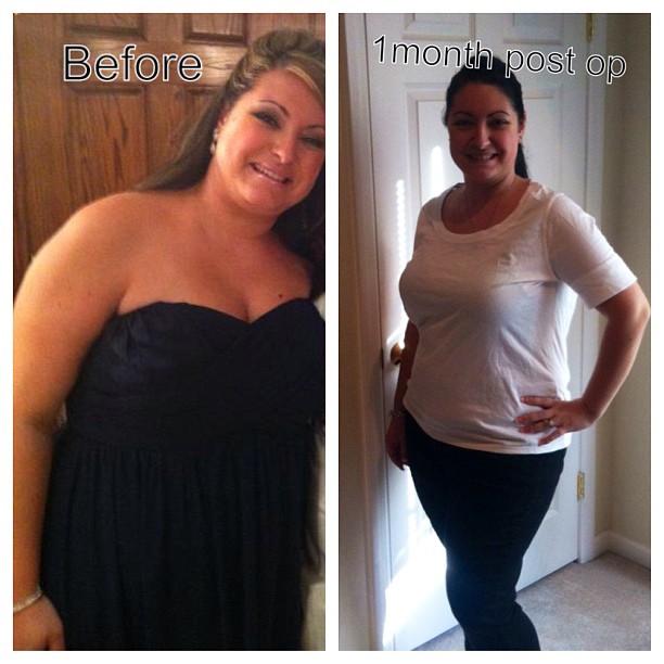 Before & After Pics