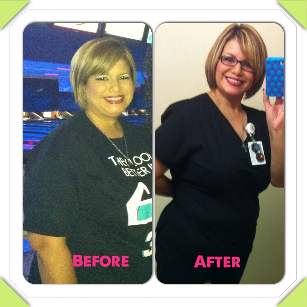 Before and after