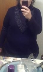 Before surgery 287lbs