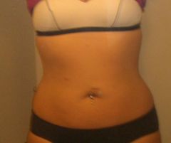 belly

6.16.09