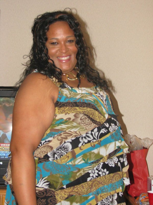 Before Surgery Pic
