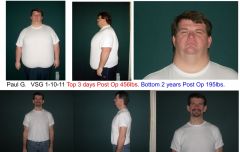 2 year comparison
