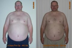 Front Shot Shirt Off (4 Months)