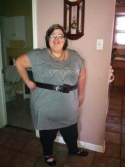 Me Two weeks post Op