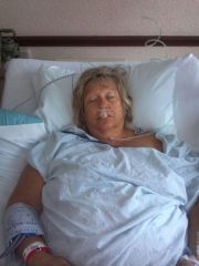 Day of surgery