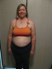 260 Before Surgery