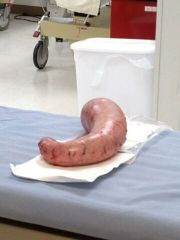 Mi Docotor Hopsital - Tijuana *GRAPHIC*