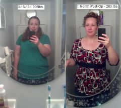 1 Month Post-Op 5-7-13