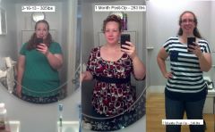 Progress to 2 Months Post-Op