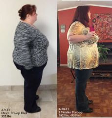 progress 4.28b