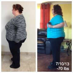 131 days post op