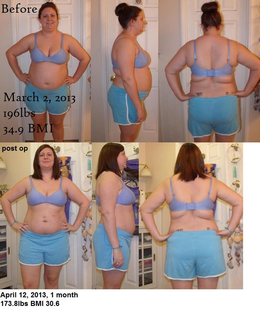 Progress Pics