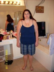 Dec 28th day before surgery