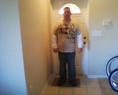 3 days post op minus 22 lbs