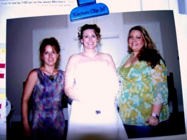 Before Surgery