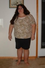 Day before surgery, 270 pds