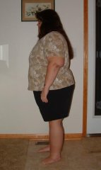 Day before surgery, 270 pds