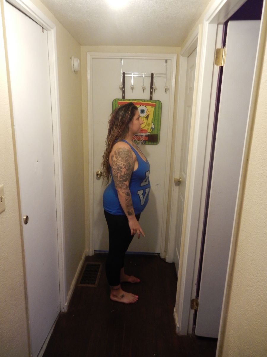 2 month after surgery