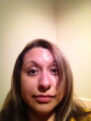 Pre surgery