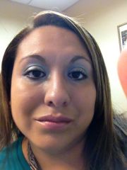 Pre Surgery