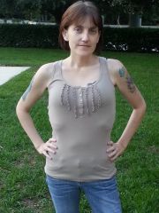 You can see my excess skin