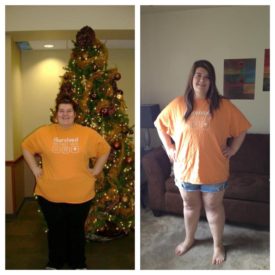 6 months post-op : )