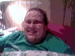 couple days post op