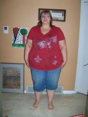 Before front view