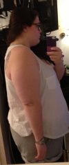 2 Weeks After Surgery, Side. Weight: 277 pounds