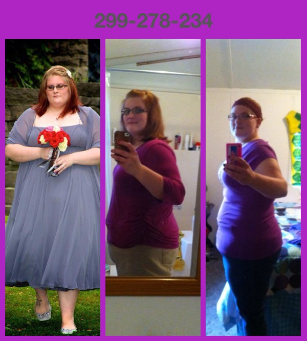 19 weeks post op baby!