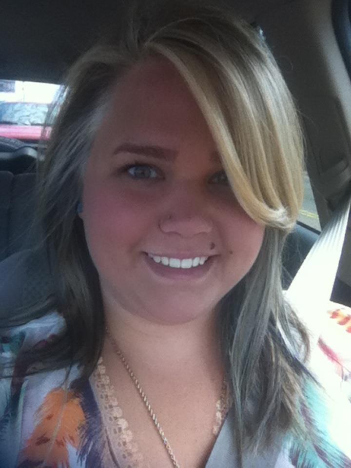 Pre-Surgery Photos (Before)