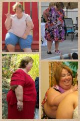 Before being sleeved by Baja Bariatrics