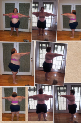 pictures from before preop diet to now.  68 lbs down