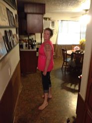 23 wks post op