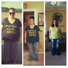 Pre-op, one month post-op and 7 weeks post-op