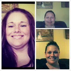 Pre-op (day of surgery), one month post-op, and 7 weeks post-op