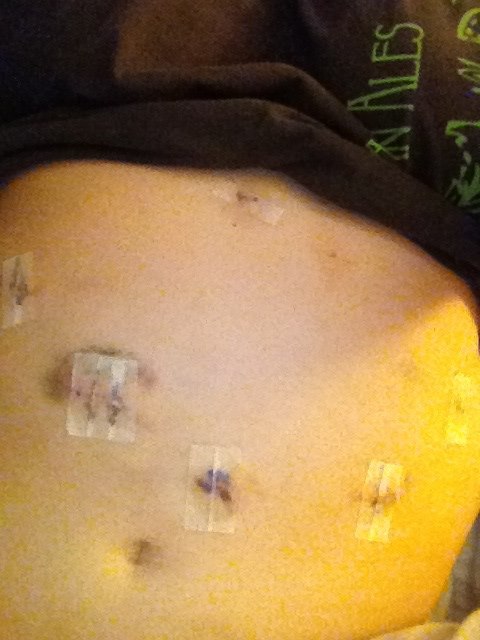 Surgery pics