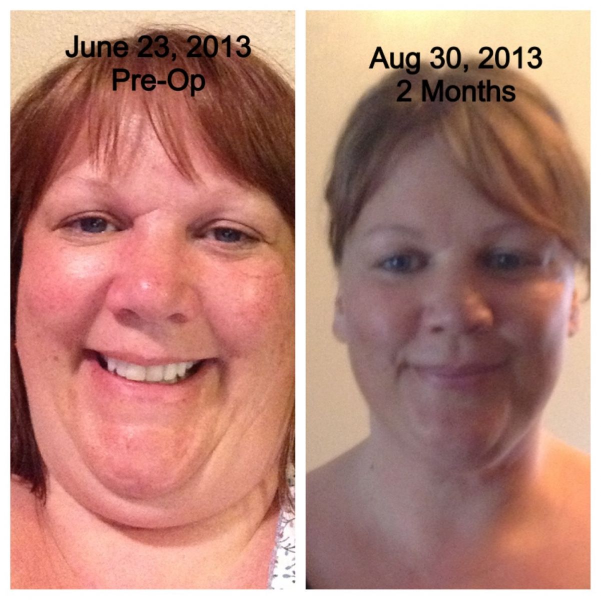 2 Months Comparison
