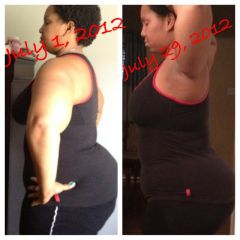 17 days before surgery and 13 days post op (side)