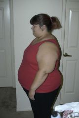 Pre-op 5/6/12