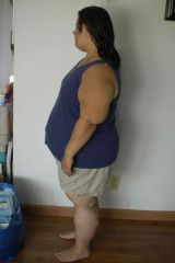 Post-op 8/7/12