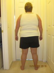 day of surgery 12-26-2012