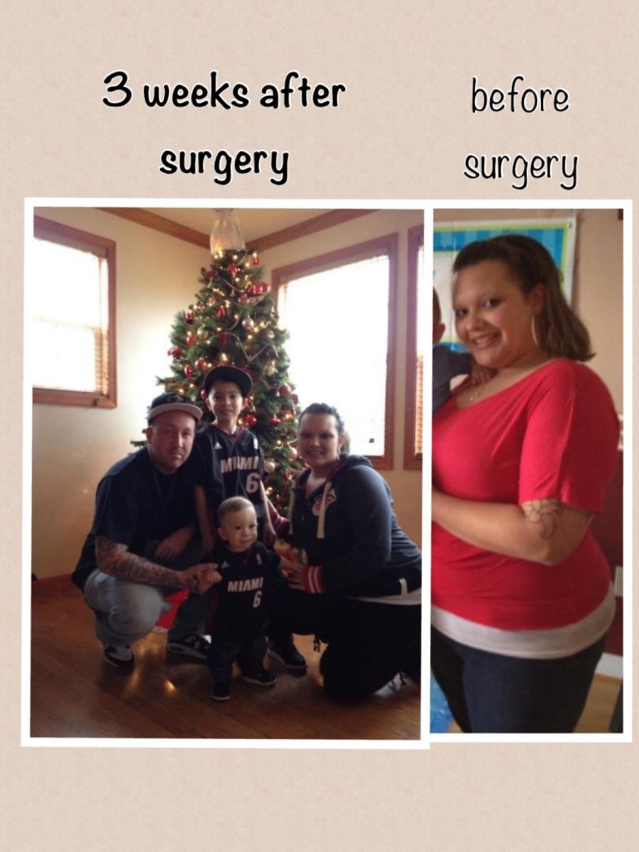 before and after