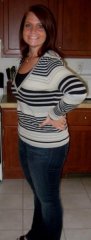 4 Months post-op