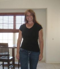 1 Year 1 month post-op