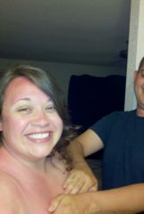 OMG sunburn