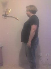 saggy elbow fat