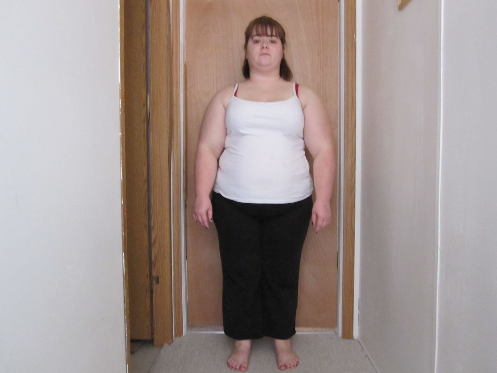 Before and After Pics